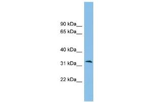 WB Suggested Anti-ZPBP2 Antibody Titration: 0. (ZPBP2 anticorps  (Middle Region))