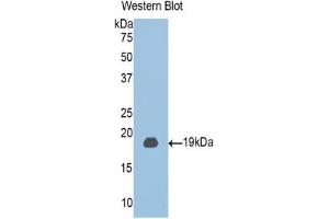 Western blot analysis of the recombinant protein. (CLIC4 anticorps  (AA 104-253))