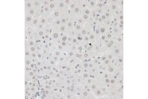 Immunohistochemistry of paraffin-embedded human colon using ZNF148 antibody (ABIN6130815, ABIN6150463, ABIN6150464 and ABIN6222770) at dilution of 1:100 (40x lens).