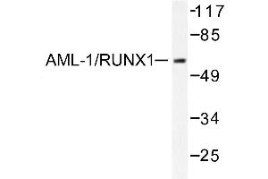 Image no. 1 for anti-Runt-Related Transcription Factor 1 (RUNX1) antibody (ABIN271868) (RUNX1 anticorps)