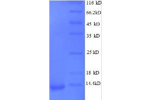 SDS-PAGE (SDS) image for GRO alpha Protein (GRO-A) (AA 35-107) protein (His tag) (ABIN5712451) (GRO alpha Protein (GRO-A) (AA 35-107) protein (His tag))