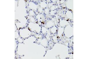 Immunohistochemistry of paraffin-embedded mouse lung using S100 Rabbit pAb (842) at dilution of 1:100 (40x lens). (S100A9 anticorps  (AA 1-114))