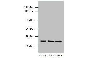 Western blot All lanes: WDYHV1 antibody at 6 μg/mL Lane 1: Mouse heart tissue Lane 2: MCF-7 whole cell lysate Lane 3: U251 whole cell lysate Secondary Goat polyclonal to Rabbit IgG at 1/10000 dilution Predicted band size: 24, 17 kDa Observed band size: 24 kDa (WDYHV1 anticorps  (N-Term))