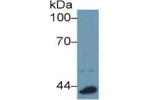 Rabbit Capture antibody from the kit in WB with Positive Control: Sample Mouse lung lysate.