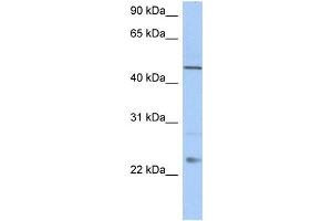 WB Suggested Anti-TMCO1 Antibody Titration:  0. (TMCO1 anticorps  (C-Term))