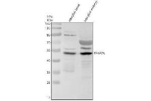 Western blot analysis of TFAP2A using anti-TFAP2A antibody (AZA0A2R8QRQ5).