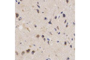 Immunohistochemistry of paraffin-embedded rat brain using PPP2R4 antibody at dilution of 1:200 (x400 lens)