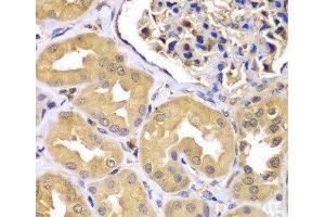 Immunohistochemistry of paraffin-embedded Human kidney using LZTR1 Polyclonal Antibody at dilution of 1:100 (40x lens). (LZTR1 anticorps)