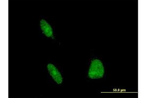 Immunofluorescence of monoclonal antibody to ERCC1 on HeLa cell. (ERCC1 anticorps  (AA 207-281))