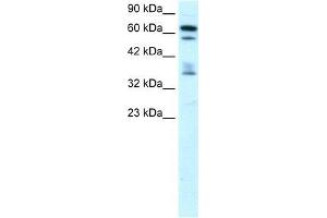 Human Brain; WB Suggested Anti-ZNF512 Antibody Titration: 0. (ZNF512 anticorps  (Middle Region))