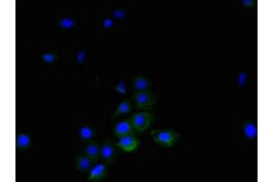 Immunofluorescent analysis of A431 cells using ABIN7173806 at dilution of 1:100 and Alexa Fluor 488-congugated AffiniPure Goat Anti-Rabbit IgG(H+L)