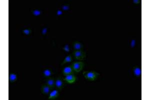 Immunofluorescent analysis of A431 cells using ABIN7173806 at dilution of 1:100 and Alexa Fluor 488-congugated AffiniPure Goat Anti-Rabbit IgG(H+L) (TNFSF14 anticorps  (AA 1-239))
