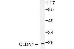 Image no. 1 for anti-Claudin 1 (CLDN1) antibody (ABIN265358) (Claudin 1 anticorps)