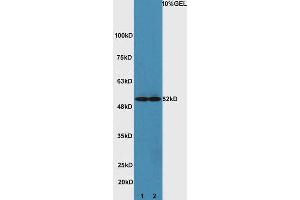 Lane 1: mouse heart lysates Lane 2: mouse brain lysate probed with Rabbit Anti-ATG4D Polyclonal Antibody, Unconjugated (ABIN752473) at 1:300 overnight at 4 °C. (ATG4D anticorps  (AA 381-474))