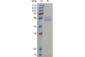 Cynomolgus MDK Protein,  hFc Tag on SDS-PAGE under reducing condition.