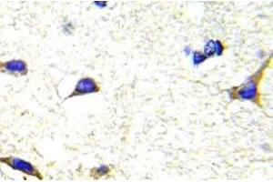 Immunohistochemistry (IHC) analyzes of LIMK1/2 antibody in paraffin-embedded human brain tissue. (LIM Domain Kinase 1 anticorps)