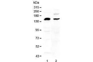 Western blot testing of human 1) U-87 MG and 2) MDA-MB-453 cell lysate with NEDD4 antibody at 0. (NEDD4 anticorps)