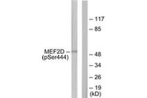 Western blot analysis of extracts from HepG2 cells treated with forskolin 40nM 30', using MEF2D (Phospho-Ser444) Antibody. (MEF2D anticorps  (pSer444))