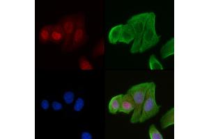 ABIN6265292 and ABIN6278636 staining Hela cells(30 min of UV treatment) by IF/ICC.