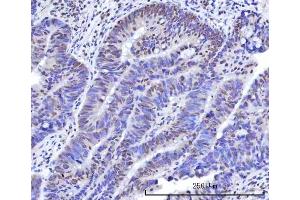 IHC analysis of RBM15B using anti-RBM15B antibody (ABIN7600219). (RBM15B anticorps  (AA 164-890))