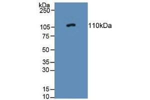 Figure. (PTPRN anticorps  (AA 368-575))