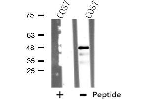 Western blot analysis of extracts from COS7 cells, using TSSC1 antibody. (TSSC1 anticorps)