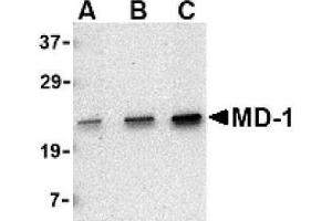 Image no. 1 for anti-Lymphocyte Antigen 86 (LY86) (C-Term) antibody (ABIN265131) (LY86 anticorps  (C-Term))