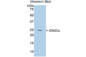 Western Blotting (WB) image for anti-RalA Binding Protein 1 (RALBP1) (AA 192-380) antibody (ABIN1176607) (RALBP1 anticorps  (AA 192-380))