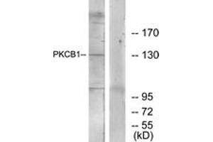 Western blot analysis of extracts from 293 cells, using PKCB1 Antibody.