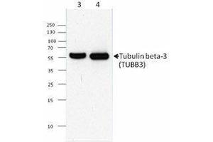Western Blotting (WB) image for anti-Tubulin, beta 3 (TUBB3) antibody (ABIN2665448) (TUBB3 anticorps)