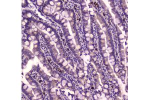 IHC analysis of IGF2R using anti-IGF2R antibody . (IGF2R anticorps  (AA 424-529))