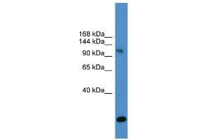WB Suggested Anti-USP8  Antibody Titration: 0.
