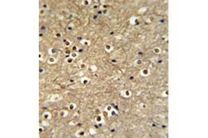 Formalin fixed and paraffin embedded brain tissue reacted with ETS2 Antibody (Center) followed by peroxidase conjugation of the secondary antibody and DAB staining. (ETS2 anticorps  (Middle Region))