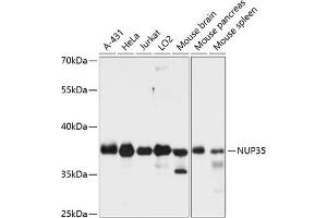 Western blot analysis of extracts of various cell lines, using NUP35 antibody (ABIN6129527, ABIN6144960, ABIN6144961 and ABIN6216505) at 1:3000 dilution. (NUP35 anticorps  (AA 1-326))