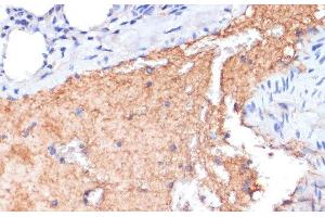 Immunohistochemistry of paraffin-embedded Mouse lung using APOA1 Polyclonal Antibody at dilution of 1:100 (40x lens). (APOA1 anticorps)