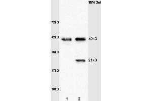 L1 rat brain lysates L2 human colon carcinoma lysates probed with Anti- Syndecan 4 Polyclonal Antibody, Unconjugated (ABIN681793) at 1:200 overnight at 4 °C. (SDC4 anticorps  (AA 101-198))