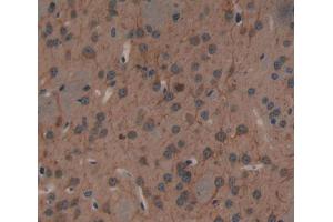 Used in DAB staining on fromalin fixed paraffin- embedded Kidney tissue
