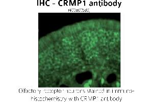 Image no. 1 for anti-GABA Transporter 1 (GAT1) (C-Term) antibody (ABIN346940) (SLC6A1 anticorps  (C-Term))