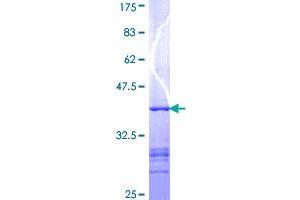 Image no. 1 for Spastic Paraplegia 7 (SPG7) (AA 655-754) protein (GST tag) (ABIN1321156)