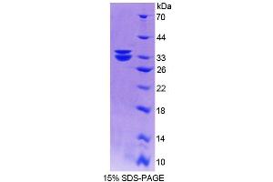 SDS-PAGE analysis of Human MTUS1 Protein.