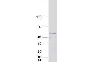 Validation with Western Blot