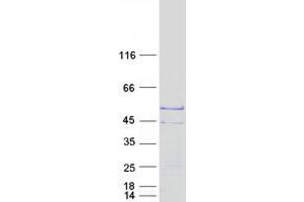 TSPY2 Protein (Myc-DYKDDDDK Tag)