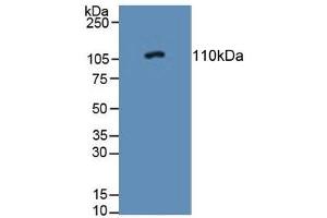 Detection of PTPRN in Rat Adrenal Gland Tissue using Polyclonal Antibody to Protein Tyrosine Phosphatase Receptor Type N (PTPRN) (PTPRN anticorps  (AA 368-575))