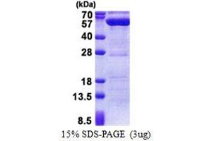 SDS-PAGE (SDS) image for Protein Phosphatase 1F (PP2C Domain Containing) (PPM1F) (AA 1-454) protein (His tag) (ABIN5853181)