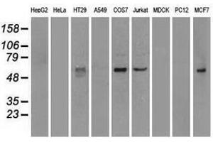 Image no. 5 for anti-Nuclear Receptor Binding Protein 1 (NRBP1) antibody (ABIN1499825)