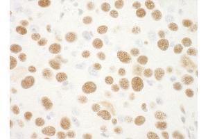 Immunohistochemistry (IHC) image for anti-Nucleophosmin (Nucleolar phosphoprotein B23, Numatrin) (NPM1) (AA 250-294) antibody (ABIN7448992) (NPM1 anticorps  (AA 250-294))