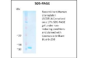SDS-PAGE (SDS) image for Secretoglobin, Family 1A, Member 1 (Uteroglobin) (SCGB1A1) (Active) protein (ABIN5509511)