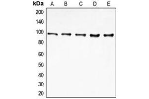 Western blot analysis of EIF4G2 expression in MCF7 (A), HeLa (B), K562 (C), Jurkat (D), HepG2 (E) whole cell lysates. (EIF4G2 anticorps  (N-Term))