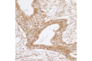 Immunohistochemistry (IHC) image for anti-TNF Receptor-Associated Protein 1 (TRAP1) (AA 50-100) antibody (ABIN7455062) (TRAP1 anticorps  (AA 50-100))