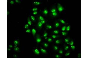 Immunofluorescence staining of Hela cells with ABIN7172427 at 1:200, counter-stained with DAPI. (TCEA3 anticorps  (AA 79-169))